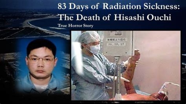 The Hisashi Ouchi Real Story: A Deep Look into the Tokaimura Accident's Human Impact
